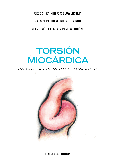 Torsión miocárdica