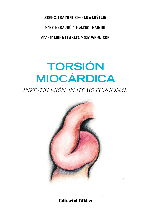 Torsión miocárdica