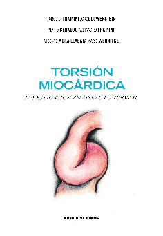 Torsión miocárdica